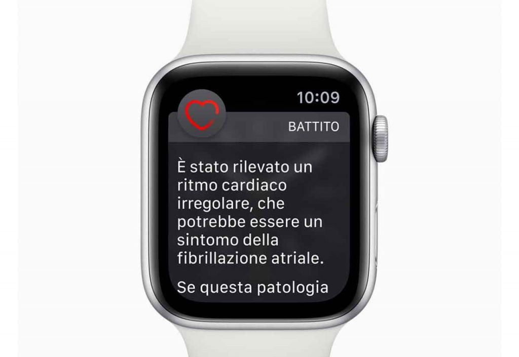 Apple, ECG di Apple Watch copiato? (Foto Wired)