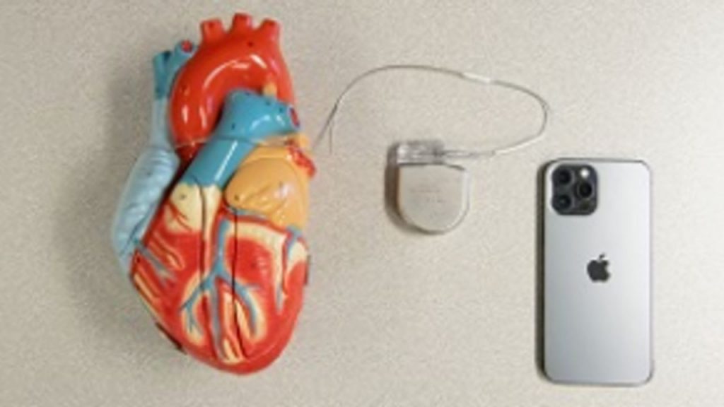 iPhone 12 e i problemi al cuore (Foto Nbc25news)