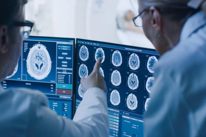 Come Capire Se Hai Un Tumore Al Cervello