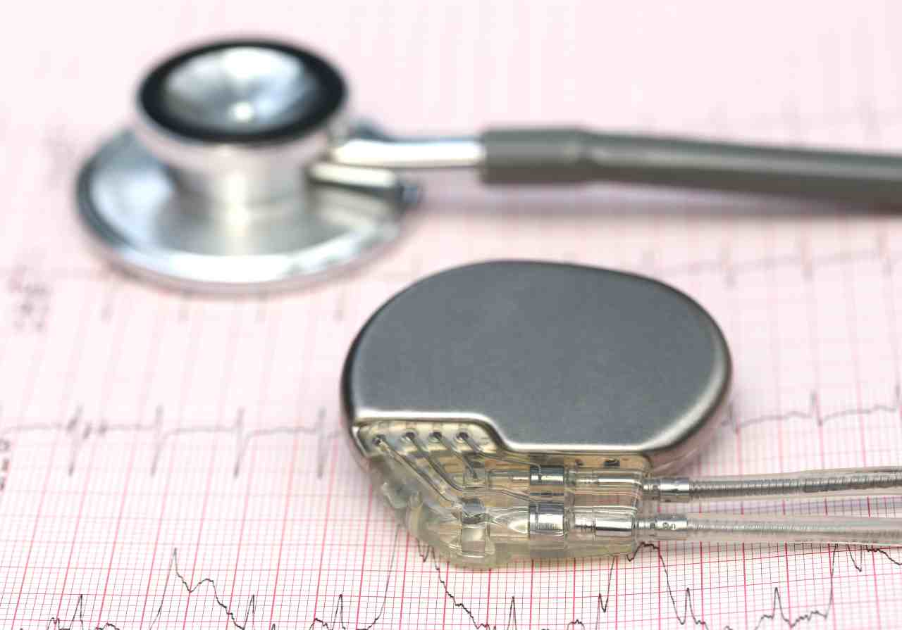 Esami cardiaci e pacemaker (Adobe Stock)